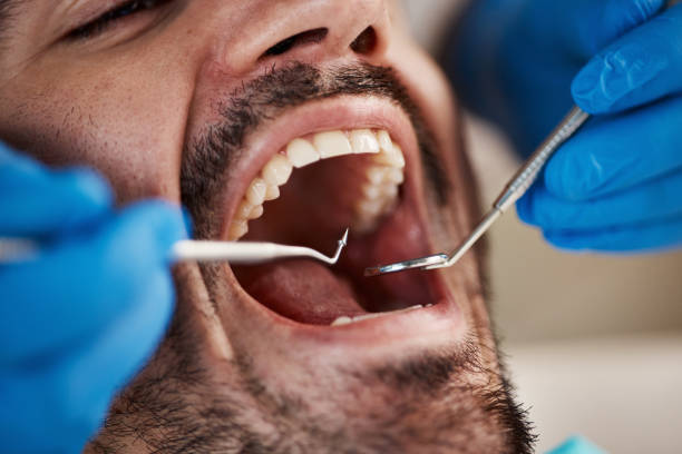 Best Urgent Tooth Repair  in Chesterland, OH