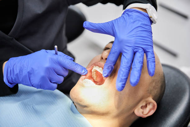 Best Chipped Tooth Repair Near Me  in Chesterland, OH